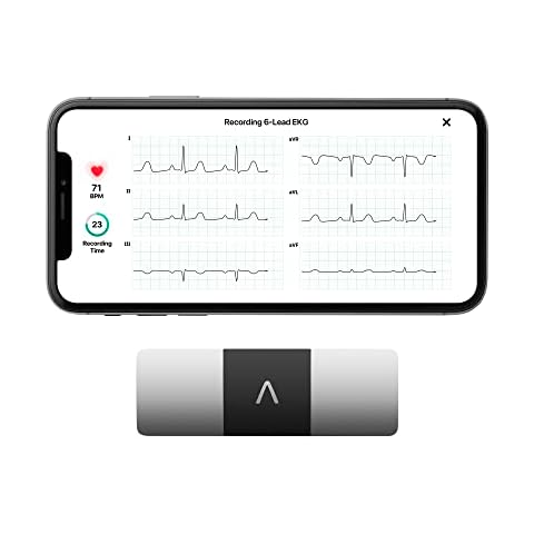 AliveCor thumbnail